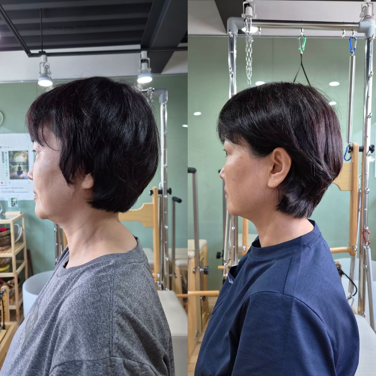 버섯목과 전방머리자세 운동 과정에서 촬영한 같은 회원의 옆모습 비교